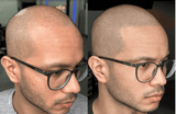 RECLAIM SET BY STEVEY G | 6 PIGMENTOS SMP | PERMA BLEND LUXEPerma Blend LUXE — Reclaim Set by Stevey G | 6 Pigmentos SMP | México Colección especializada para Scalp Micropigmentation desarrollada con el experto internacional Stevey G. Pigmentos formulados